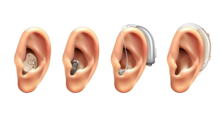 Top Hearing Aid Dealers in Kolkata